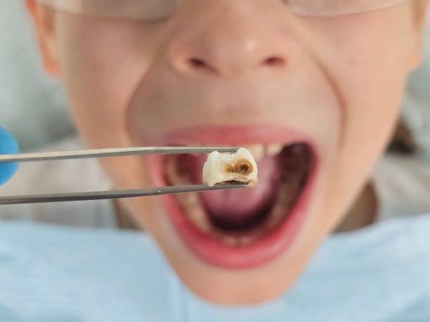 Best Emergency Dentist for Kids  in Garyville, LA